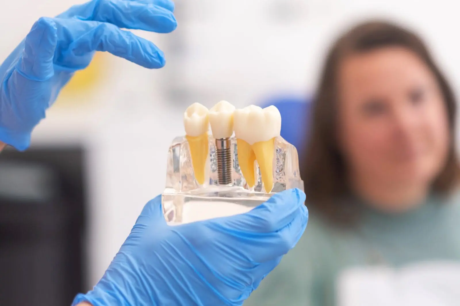 Close-up of dental model with implant. patient of dental clinic on blurred background.
