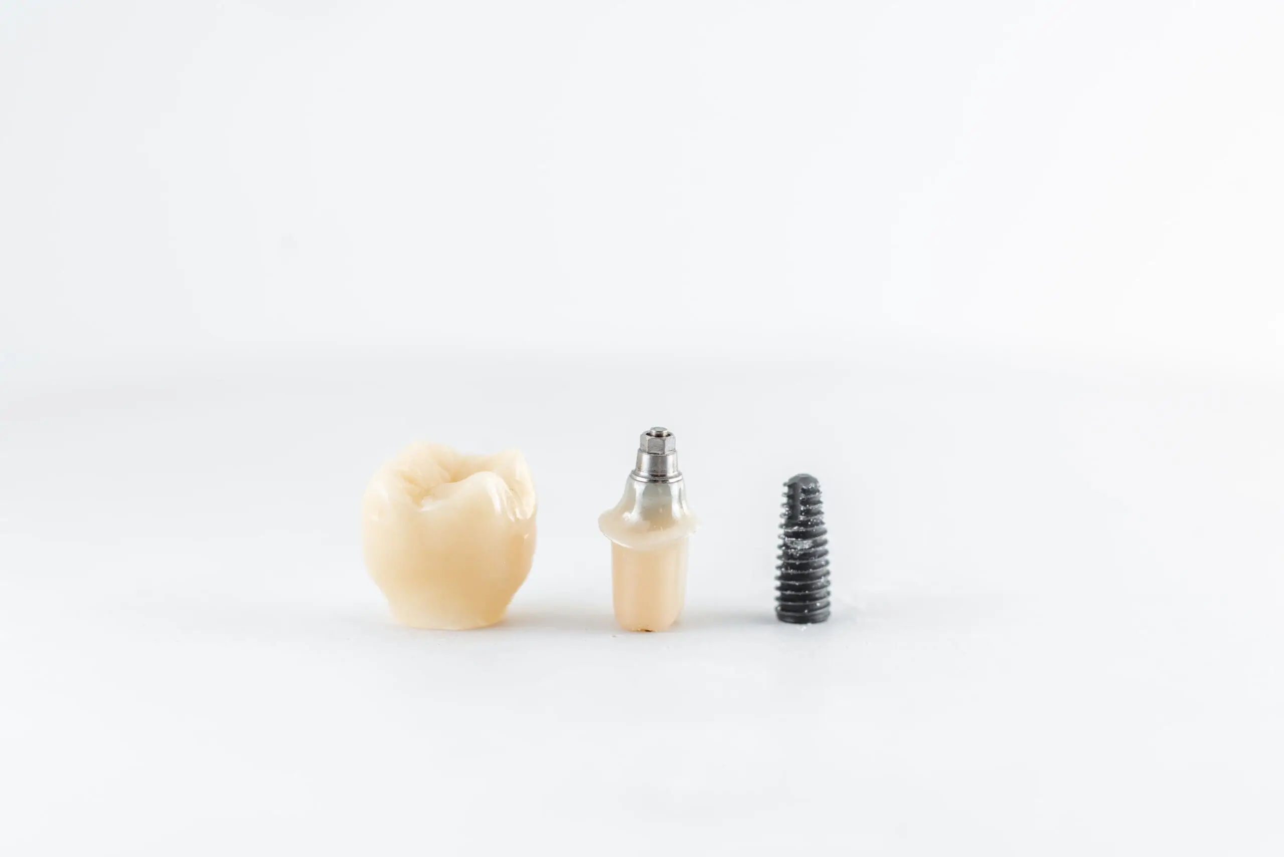 Dental implant with screw and crown