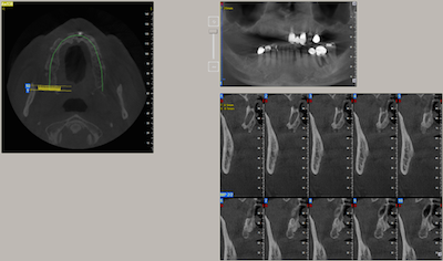 image1-15