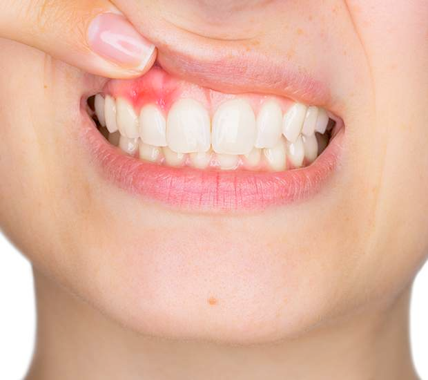 crown-lengthening