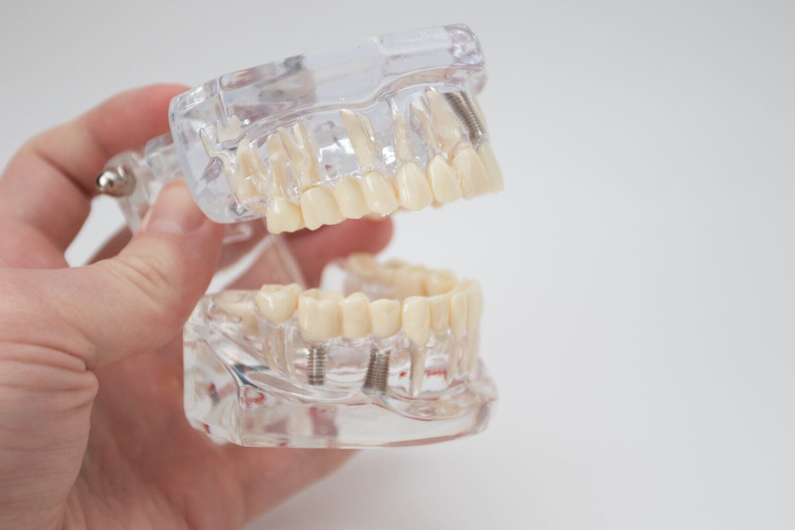 Demonstration model of a human jaw