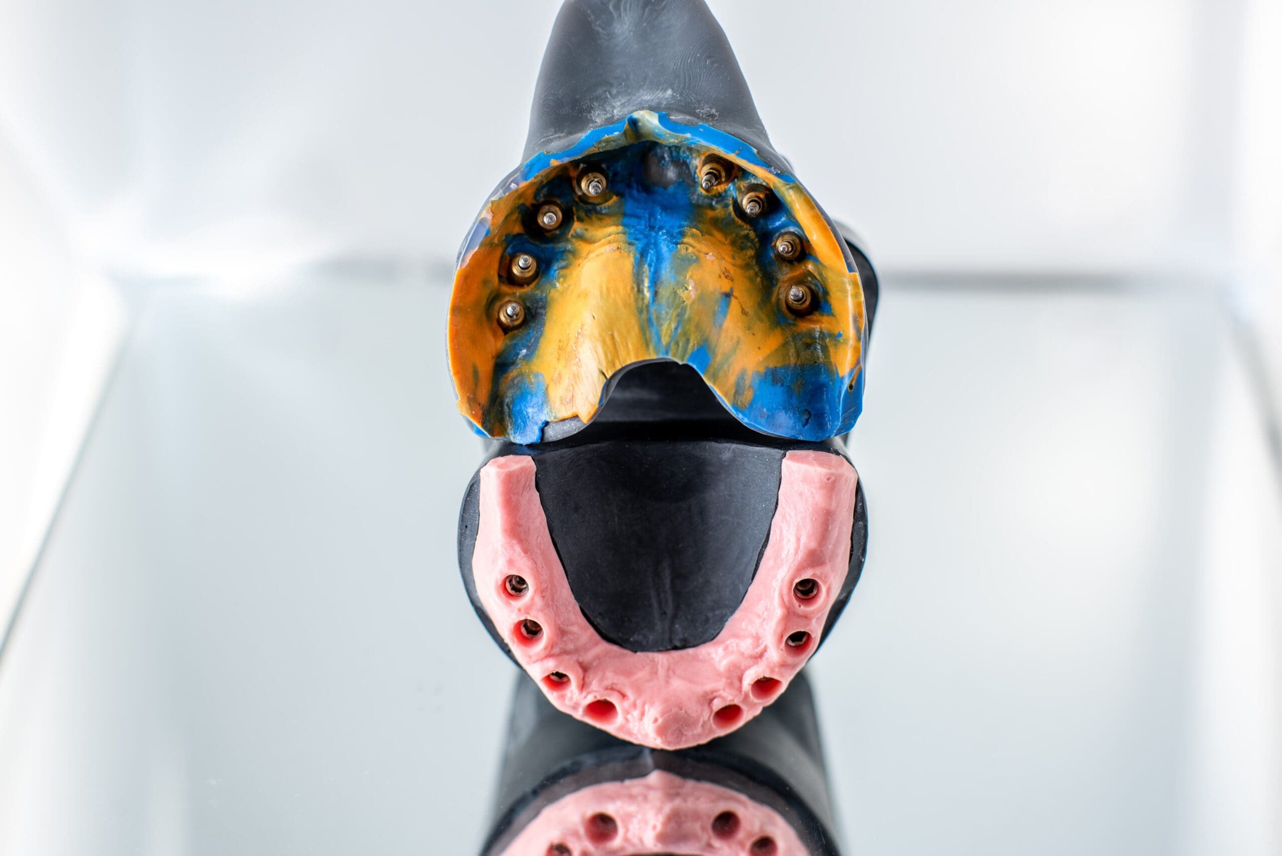 Jaw impressions for implants modeling
