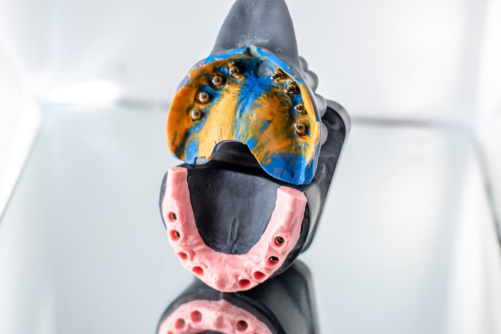 Jaw impressions for implants modeling